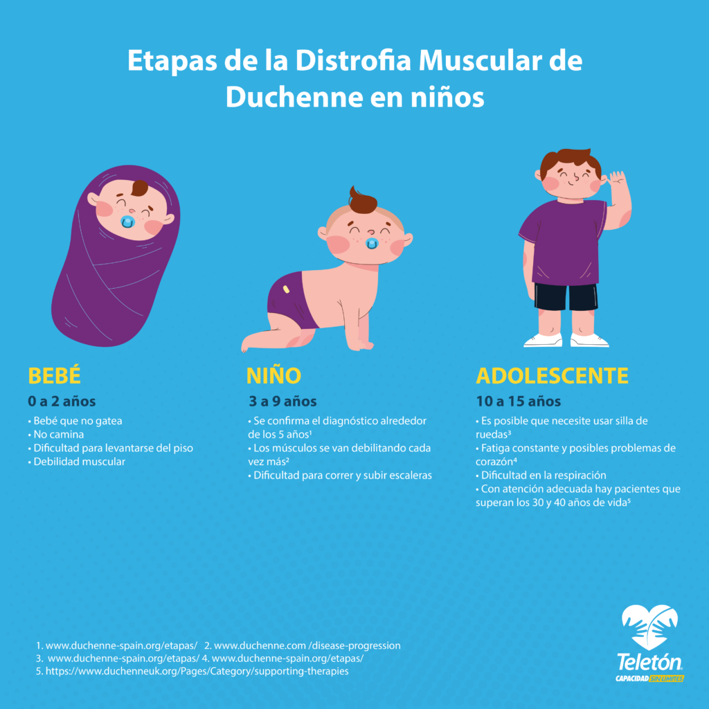 Infografía con el título “Etapas de la Distrofia Muscular de Duchenne en niños” y tres ilustraciones de tres niños de diferentes edades. La primera ilustración de un bebé con el texto: “0 a 2 años. Bebé que no gatea. No camina. Dificultad para levantarse del piso. Debilidad muscular”. La segunda ilustración de un niño con el texto: “3 a 9 años. Se confirma el diagnóstico alrededor de los 5 años. Los músculos se van debilitando cada vez más. Dificultad para correr y subir escaleras”. La tercera ilustración de un adolescente con el texto: “10 a 15 años. Es posible que necesite usar silla de ruedas. Fatiga constante y posibles problemas del corazón. Dificultad en la respiración. Con atención adecuada hay pacientes que superan los 30 y 40 años de vida”. En la parte inferior derecha se muestra el logo de Teletón.
