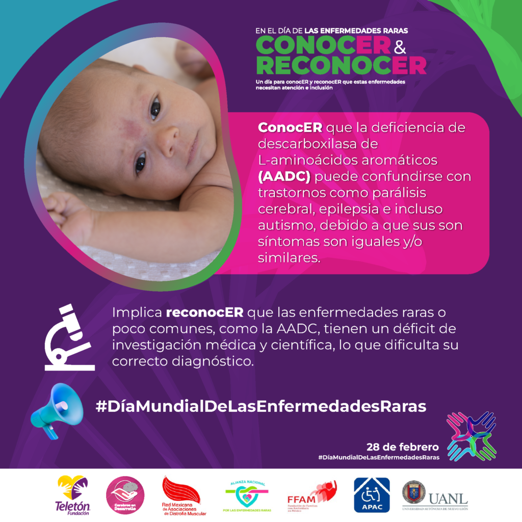 Conocer que la deficiencia de descarboxilasa de L-aminoácidos aromáticos (AADC) puede confundirse con trastornos como parálisis cerebral, epilepsia e incluso autismo, debido a que sus síntomas son iguales y o similares. Implica reconocer que las enfermedades raras o poco comunes como la AADC tienen un déficit de investigación médica y científica, lo que dificulta su correcto diagnóstico. 